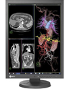 https://eizo.es/monitores-medicina/monitores-diagnostico-radiologia/